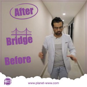 befor after bridge - mehde mohamad