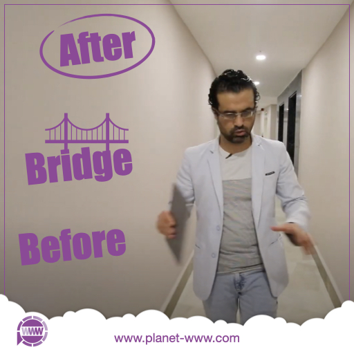 befor after bridge - mehde mohamad