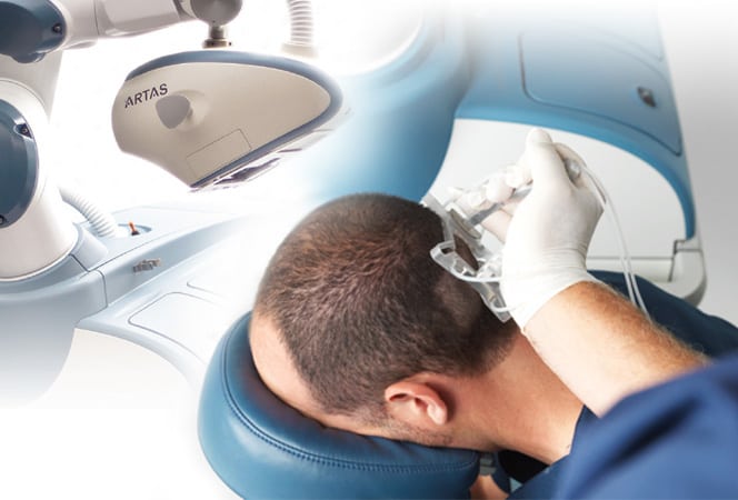 زراعة الشعر بالروبوت ميزات وعيوب