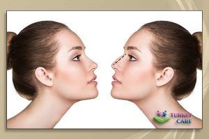 cosmetic-nose-turkey