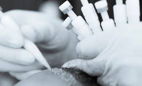 زراعة الشعر في ديفا كلينك