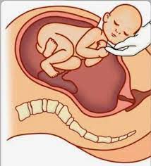 تمارين بعد الولادة القيصرية