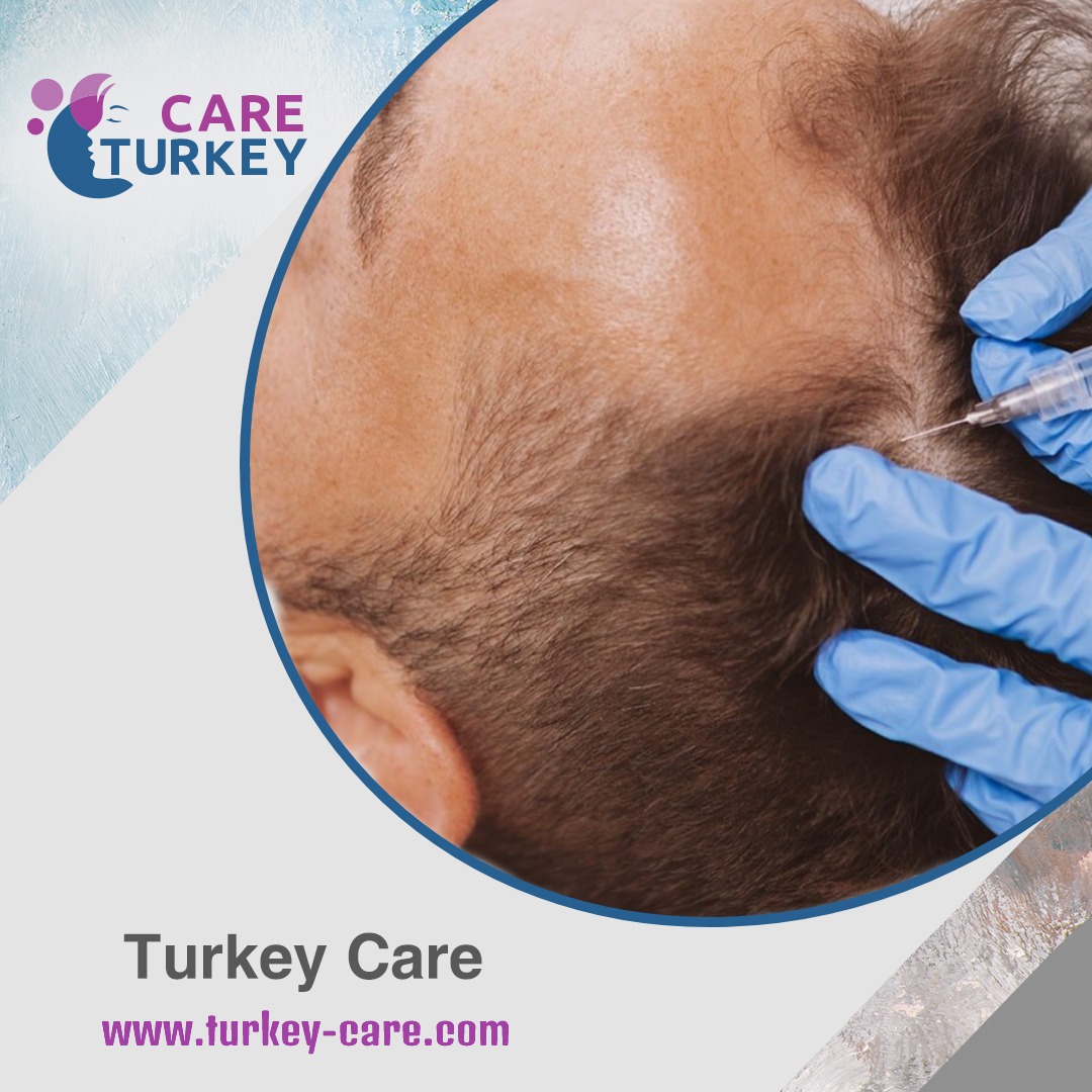 كم يستغرق نمو الشعر بعد الزراعة؟ مراحل النمو