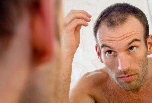 DailyMedicalinfo1_rf_photo_of_balding_man_in_mirror